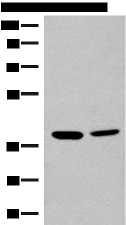 Polyclonal Rabbit anti-Human MRM1 Antibody (WB)