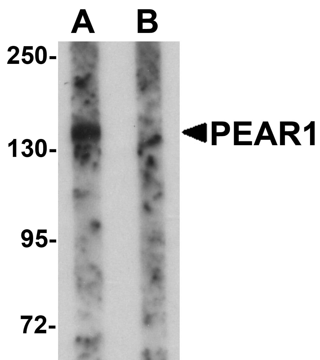 Polyclonal Rabbit anti-Human PEAR1 Antibody (IHC, IF, WB)