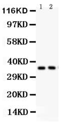 SFRP-3 / FRZB Antibody (aa176-325)