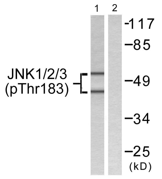 MAPK8 / JNK1 Antibody (phospho-Thr183+Tyr185)