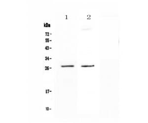 Polyclonal Rabbit anti-Human SPR Antibody (WB)