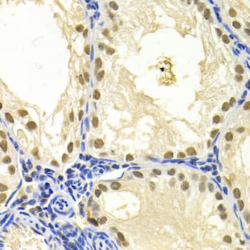 Polyclonal Rabbit anti-Human DDB1 Antibody (IHC, WB)