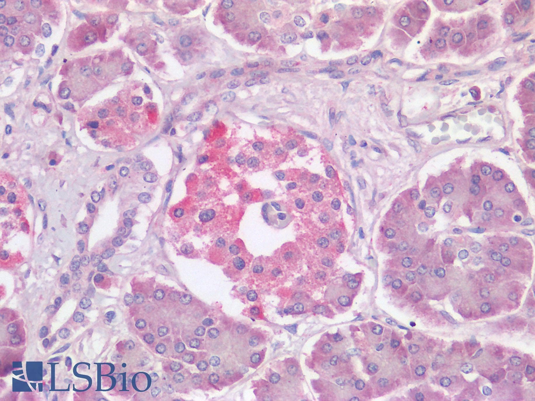 IHC-plus™ Polyclonal Rabbit anti-Human TMPRSS2 / Epitheliasin Antibody (IHC)