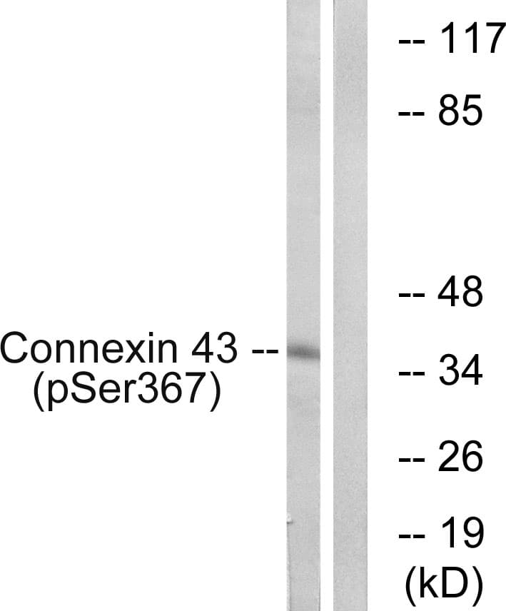 GJA1 / CX43 / Connexin 43 Antibody (phospho-Ser367)