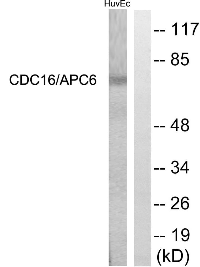 Polyclonal Rabbit anti-Human APC6 / CDC16 Antibody (aa526-575, IHC, WB)