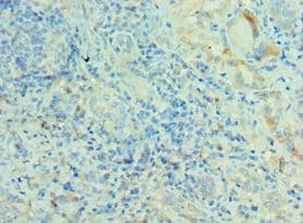 Polyclonal Rabbit anti-Human MRPL28 Antibody (aa1-256, IHC, WB)