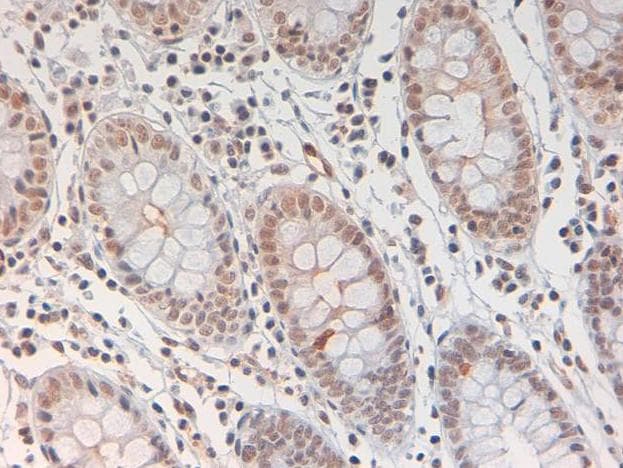 STAT3 Antibody (phospho-Tyr705)