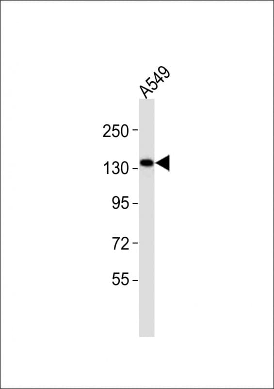 EPHA1 / EPH Receptor A1 Antibody (aa453-487)