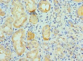 CUL5 / Cullin-5 Antibody (aa1-300)