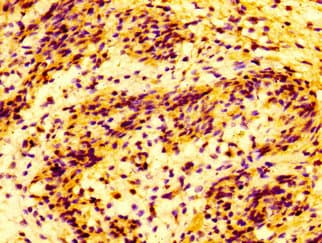 Polyclonal Rabbit anti-Human MMP28 Antibody (IHC, IF, WB)