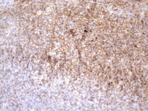 POU2AF1 / BOB1 Antibody (clone OTI13G1)