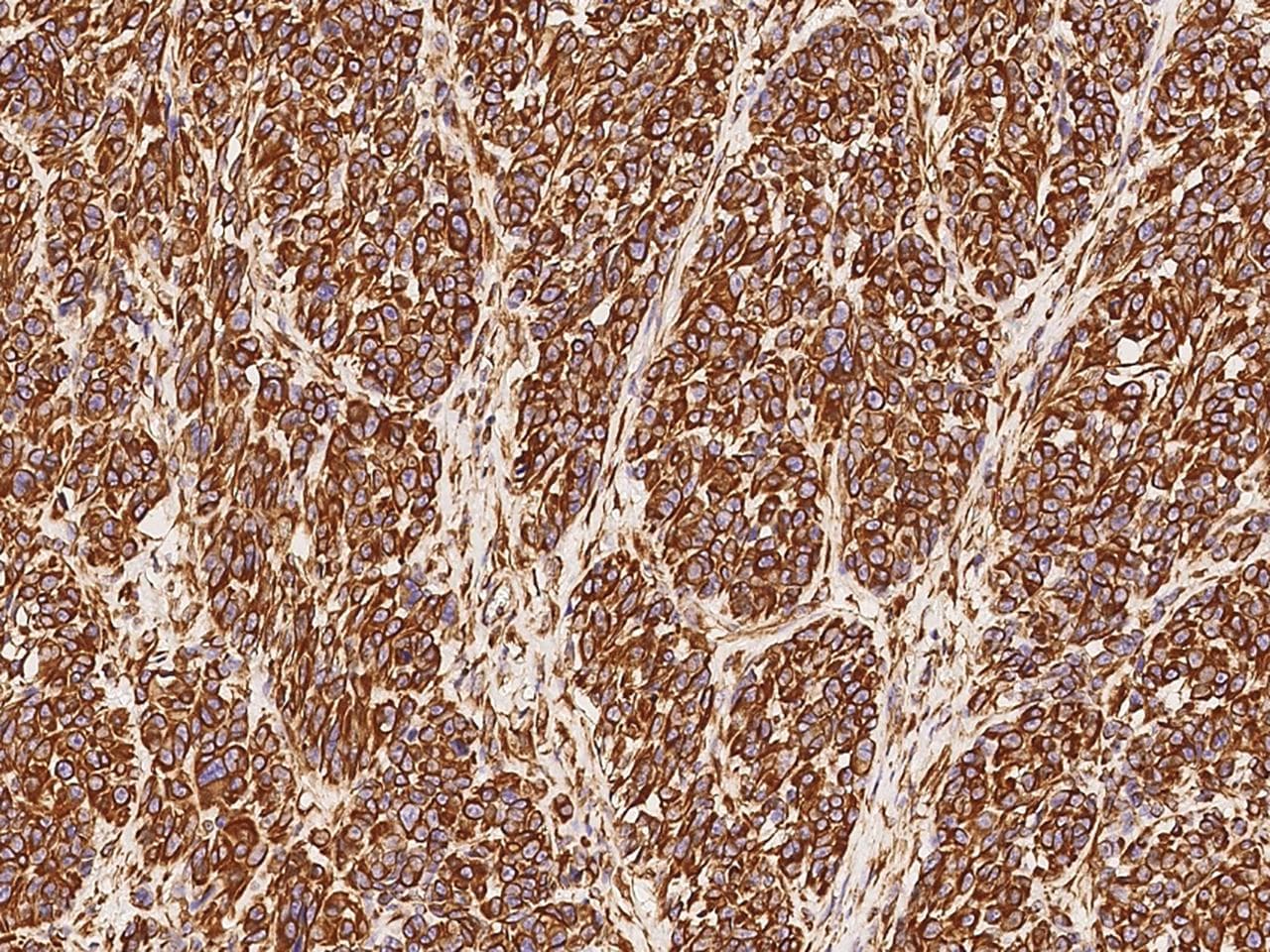 Vimentin Antibody (clone 001, Preservative Free)
