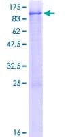 Human RLIM / RNF12 Protein (Recombinant GST)