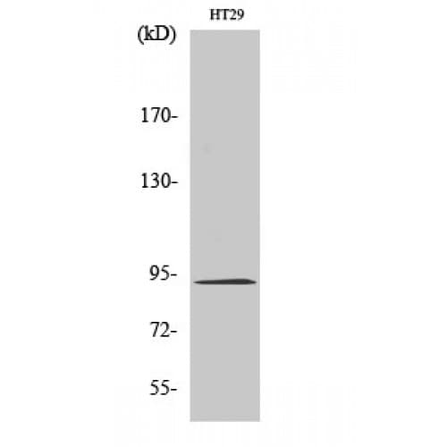 CTNNB1 / Beta Catenin Antibody (10-90 aa)
