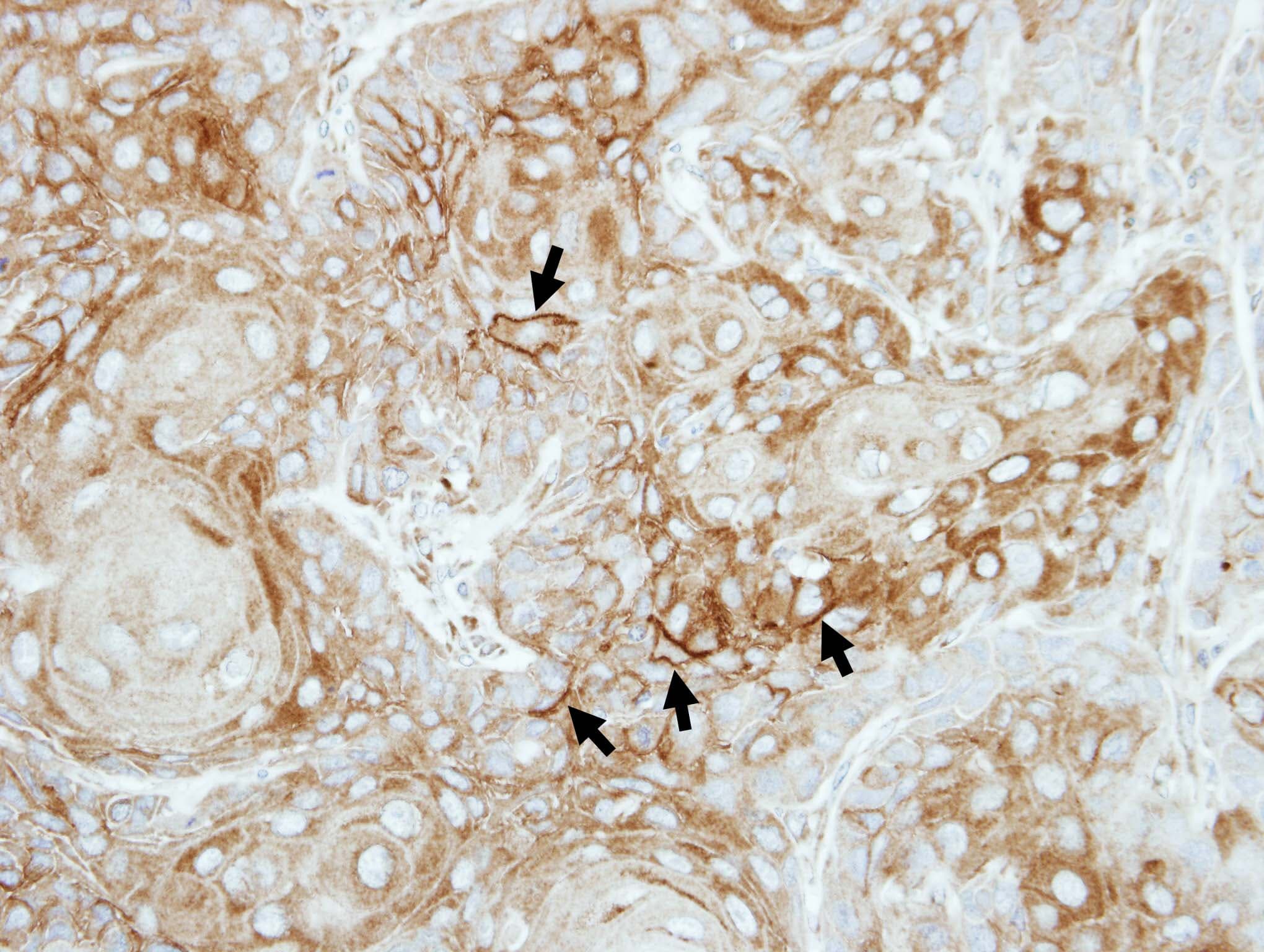 ATP1B3 Antibody (aa53-279)