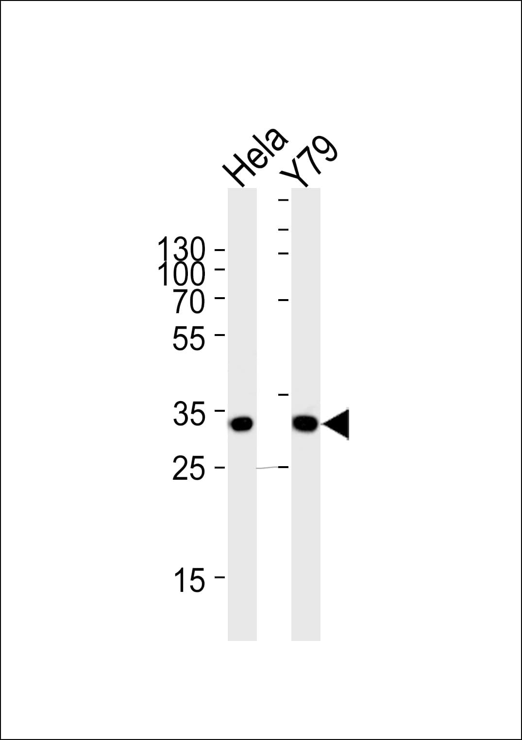 PDCL Antibody (aa1-30)