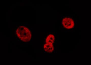 LMNA / Lamin A+C Antibody