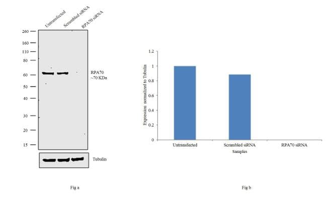 RPA70 / RPA1 Antibody (clone 4C4)