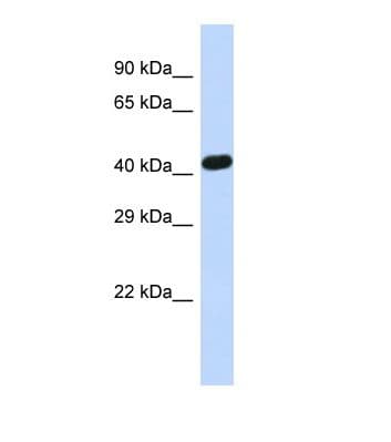 ZNF773 Antibody (aa131-180)