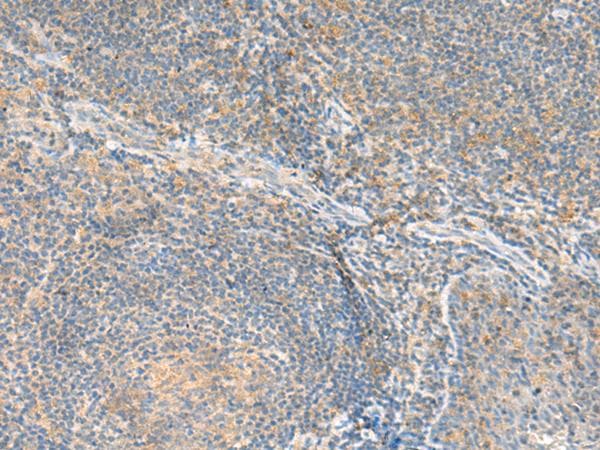 RNF207 Antibody