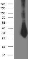 SIRT5 / Sirtuin 5 Antibody (clone OTI1A6, Carrier-free)