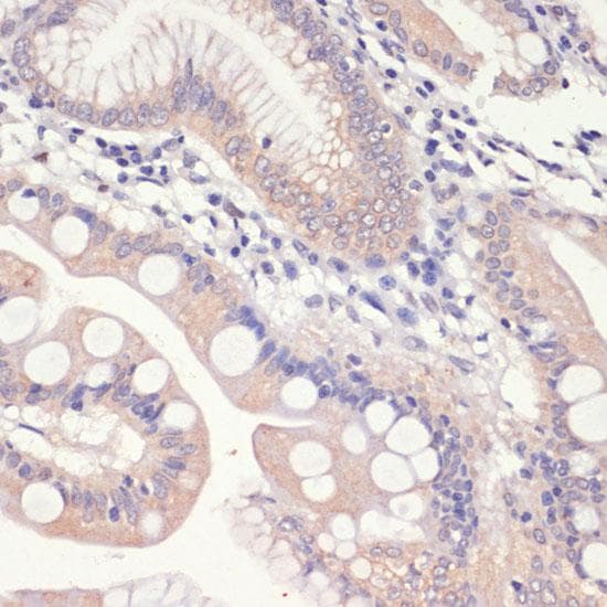 HMG-CoA Reductase / HMGCR Antibody