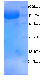 Human MYBPC2 Protein (Recombinant His)
