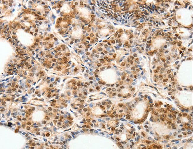 PDCD6 / ALG-2 Antibody