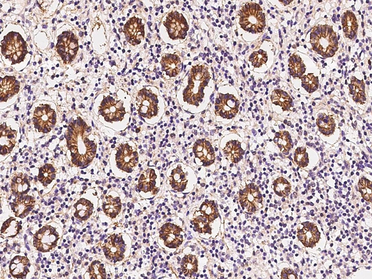 Polyclonal Rabbit anti-Human SLC15A1 / PEPT1 Antibody (IHC, IF)