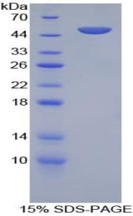 Mouse BAFF Receptor / CD268 Protein (Recombinant His-GST)