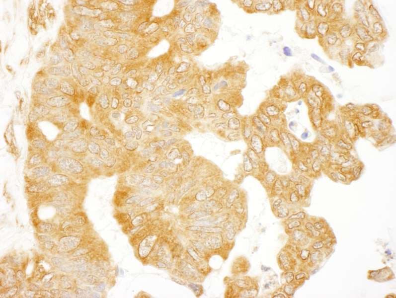EIF3B Antibody (aa100-150)