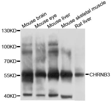 Polyclonal Rabbit anti-Human CHRNB3 Antibody (WB)