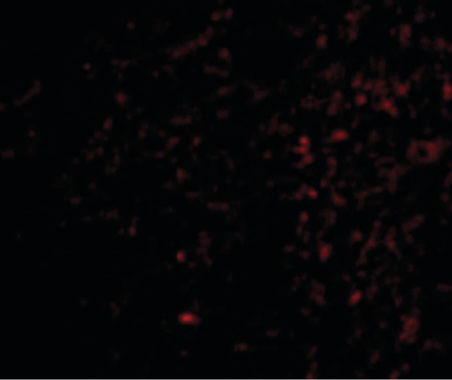 Polyclonal Rabbit anti-Human TOCA1 / FNBP1L Antibody (IHC, IF, WB)