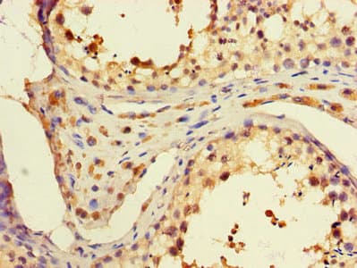 PD2 / PAF1 Antibody