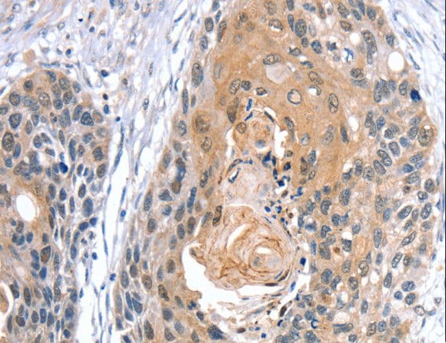GNAT3 / Gustducin Antibody