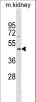 Polyclonal Rabbit anti-Human SUDS3 Antibody (aa72-98, WB)