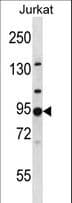 Polyclonal Rabbit anti-Human AP1G2 Antibody (aa1-30, WB)