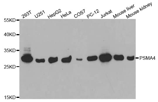Polyclonal Rabbit anti-Human PSMA4 Antibody (IHC, IF, WB)