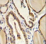 Polyclonal Rabbit anti-Human GUCY2D Antibody (aa540-570, IHC, WB)