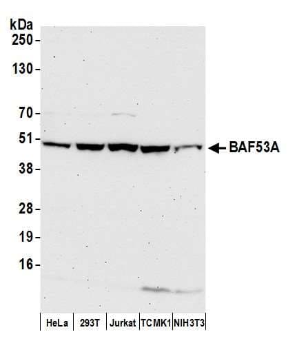 IHC-plus™ Polyclonal Rabbit anti-Human BAF53 / ACTL6A Antibody (aa25-75, IHC, WB)