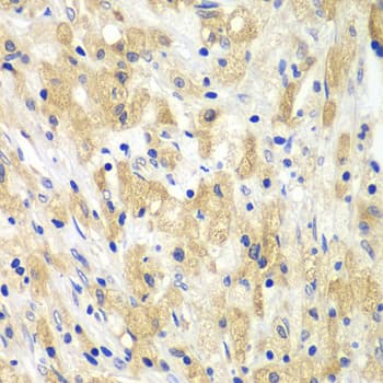 BCL2 / Bcl-2 Antibody