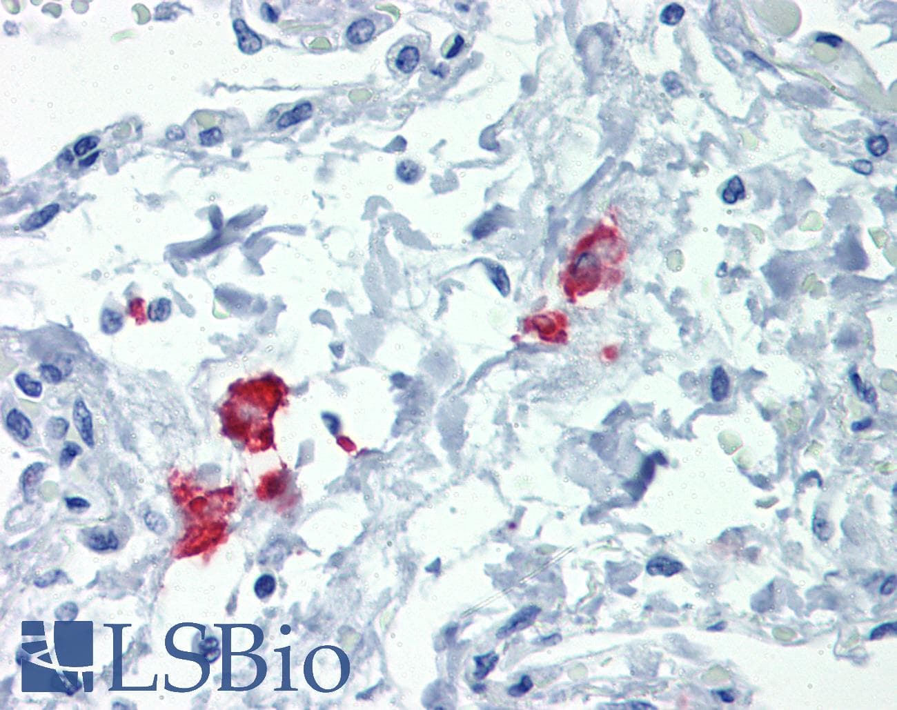 IHC-plus™ Monoclonal Rat anti-Human CD209 / DC-SIGN Antibody (clone h209, IHC)