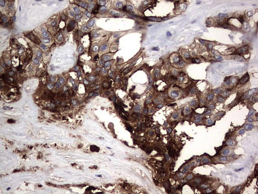 CEACAM5 / CD66e Antibody (aa35-680, clone OTI1C2)