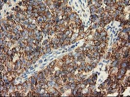 CLPP Antibody (clone OTI1G9)