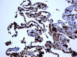 Selenium Binding Protein 1 Antibody (clone OTI3H1)