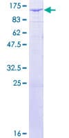 Human RPS6KA3 / RSK2 Protein (Recombinant GST)