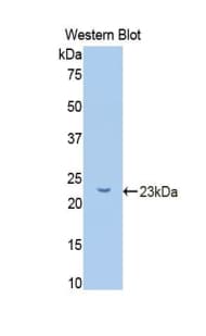 GCKR Antibody (aa90-286, Biotin)