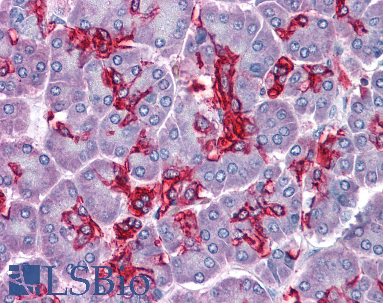 IHC-plus™ ABHD5 Antibody (aa181-192)