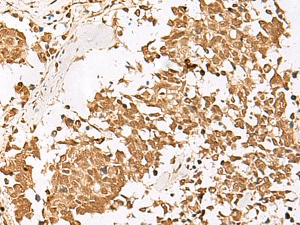 PSMD12 / Rpn5 Antibody