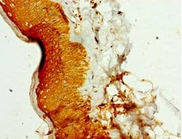 Polyclonal Rabbit anti-Human SMYD4 Antibody (aa1-260, IHC, WB)